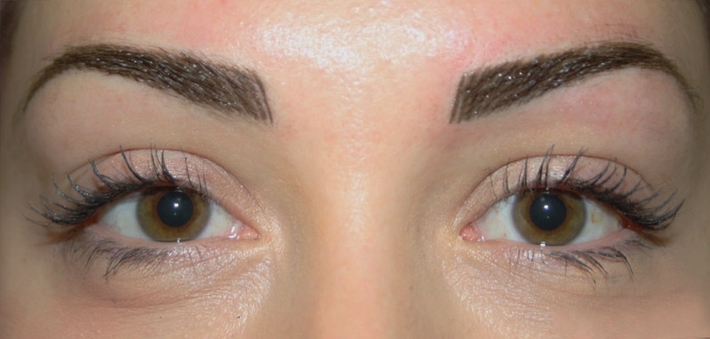 Il trucco permanente a Vicenza