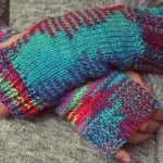 Come curare i geloni